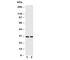 Kallikrein 1 antibody, R30716, NSJ Bioreagents, Western Blot image 