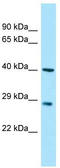 Myozenin 3 antibody, TA331274, Origene, Western Blot image 
