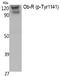 Leptin Receptor antibody, PA5-40301, Invitrogen Antibodies, Western Blot image 