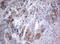 MYCBP Associated And Testis Expressed 1 antibody, M13032, Boster Biological Technology, Immunohistochemistry paraffin image 