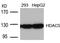 Histone Deacetylase 5 antibody, A01230-4, Boster Biological Technology, Western Blot image 