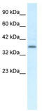 Chemerin Chemokine-Like Receptor 1 antibody, TA330389, Origene, Western Blot image 