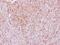 Laminin Subunit Gamma 2 antibody, PA5-22308, Invitrogen Antibodies, Immunohistochemistry frozen image 