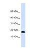 DnaJ Heat Shock Protein Family (Hsp40) Member C25 antibody, NBP1-91558, Novus Biologicals, Western Blot image 