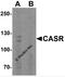Calcium Sensing Receptor antibody, 7785, ProSci, Western Blot image 