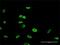 Forkhead Box P2 antibody, H00093986-M02, Novus Biologicals, Immunofluorescence image 
