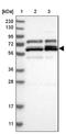 PTGES3L-AARSD1 Readthrough antibody, NBP1-81145, Novus Biologicals, Western Blot image 