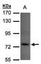 Tousled Like Kinase 1 antibody, PA5-27808, Invitrogen Antibodies, Western Blot image 