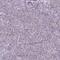 CaM Kinase Like Vesicle Associated antibody, PA5-52462, Invitrogen Antibodies, Immunohistochemistry paraffin image 