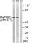 Mitogen-Activated Protein Kinase Kinase 7 antibody, LS-C199215, Lifespan Biosciences, Western Blot image 