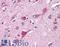 Translocase Of Outer Mitochondrial Membrane 70 antibody, LS-B2303, Lifespan Biosciences, Immunohistochemistry frozen image 