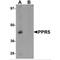 Proline Rich 5 antibody, MBS150063, MyBioSource, Western Blot image 