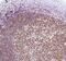 IKAROS Family Zinc Finger 1 antibody, MA5-16418, Invitrogen Antibodies, Immunohistochemistry paraffin image 