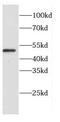 Cathepsin D antibody, FNab01305, FineTest, Western Blot image 