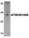 Transmembrane Protein 106B antibody, TA319942, Origene, Western Blot image 