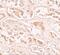 BTG3 Associated Nuclear Protein antibody, NBP1-76295, Novus Biologicals, Immunohistochemistry frozen image 