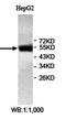 Zinc Finger Protein 345 antibody, orb78054, Biorbyt, Western Blot image 