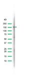 MutS Homolog 6 antibody, MA5-16380, Invitrogen Antibodies, Western Blot image 