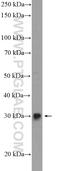 Fibroblast Growth Factor 5 antibody, 18171-1-AP, Proteintech Group, Western Blot image 