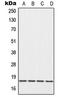 Eukaryotic Translation Initiation Factor 5A antibody, LS-C352148, Lifespan Biosciences, Western Blot image 