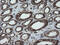Protein Disulfide Isomerase Family A Member 3 antibody, LS-C787354, Lifespan Biosciences, Immunohistochemistry paraffin image 