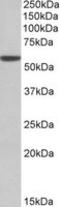 Aldehyde Dehydrogenase 3 Family Member A1 antibody, LS-B9217, Lifespan Biosciences, Western Blot image 