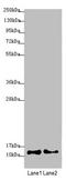 Cytochrome C Oxidase Subunit 7A2 Like antibody, LS-C675577, Lifespan Biosciences, Western Blot image 