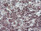 Neurolysin antibody, M03028, Boster Biological Technology, Immunohistochemistry paraffin image 