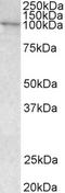 Vav Guanine Nucleotide Exchange Factor 3 antibody, LS-B3237, Lifespan Biosciences, Western Blot image 