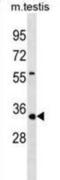 Tissue Specific Transplantation Antigen P35B antibody, abx030949, Abbexa, Western Blot image 