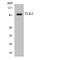 Serine/threonine-protein kinase tousled-like 2 antibody, LS-C200789, Lifespan Biosciences, Western Blot image 
