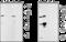 Transient Receptor Potential Cation Channel Subfamily M Member 5 antibody, GTX54864, GeneTex, Western Blot image 