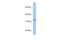 Acyl-CoA Binding Domain Containing 4 antibody, GTX45976, GeneTex, Western Blot image 