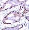 Jun Proto-Oncogene, AP-1 Transcription Factor Subunit antibody, orb14420, Biorbyt, Immunohistochemistry paraffin image 