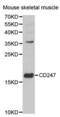 CD247 Molecule antibody, abx001675, Abbexa, Western Blot image 