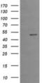Early Growth Response 2 antibody, NBP2-45696, Novus Biologicals, Western Blot image 