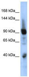 Zinc Finger Protein 507 antibody, TA339474, Origene, Western Blot image 