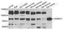 Fermitin Family Member 3 antibody, A7839, ABclonal Technology, Western Blot image 