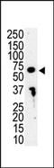 Interleukin 1 Receptor Associated Kinase 3 antibody, AP14603PU-N, Origene, Western Blot image 