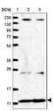NADH:Ubiquinone Oxidoreductase Subunit A2 antibody, NBP1-88968, Novus Biologicals, Western Blot image 