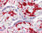 Coagulation Factor XIII A Chain antibody, 51-856, ProSci, Immunohistochemistry paraffin image 