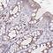 Serine/Threonine/Tyrosine Kinase 1 antibody, NBP2-13398, Novus Biologicals, Immunohistochemistry paraffin image 