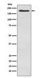 Bromodomain Adjacent To Zinc Finger Domain 1B antibody, M04438-1, Boster Biological Technology, Western Blot image 