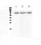 Sodium Channel Epithelial 1 Alpha Subunit antibody, A01413-1, Boster Biological Technology, Western Blot image 