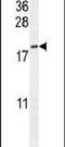 Outer Dense Fiber Of Sperm Tails 3B antibody, PA5-24301, Invitrogen Antibodies, Western Blot image 