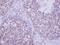 LIM Domain Kinase 2 antibody, PA5-21987, Invitrogen Antibodies, Immunohistochemistry paraffin image 