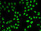 Small Nuclear Ribonucleoprotein Polypeptide A antibody, LS-C334695, Lifespan Biosciences, Immunofluorescence image 