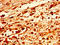 Paired box protein Pax-9 antibody, LS-C670891, Lifespan Biosciences, Immunohistochemistry paraffin image 