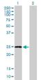 ADP Ribosylation Factor Like GTPase 11 antibody, H00115761-B01P, Novus Biologicals, Western Blot image 