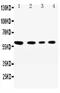 SYNCAM antibody, PA2294, Boster Biological Technology, Western Blot image 